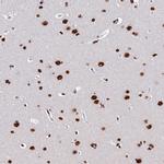 SRRM2 Antibody in Immunohistochemistry (IHC)