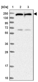 UACA Antibody in Western Blot (WB)