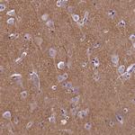 SPIRE2 Antibody in Immunohistochemistry (Paraffin) (IHC (P))