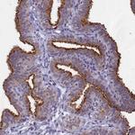 SPIRE2 Antibody in Immunohistochemistry (Paraffin) (IHC (P))
