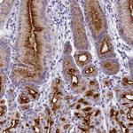 SPIRE2 Antibody in Immunohistochemistry (Paraffin) (IHC (P))