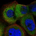 ARMC6 Polyclonal Antibody