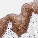 ARMC6 Antibody in Immunohistochemistry (Paraffin) (IHC (P))