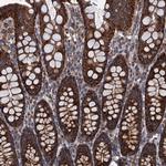 C14orf159 Antibody in Immunohistochemistry (Paraffin) (IHC (P))