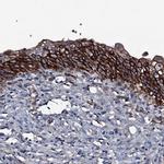 ATP5SL Antibody in Immunohistochemistry (Paraffin) (IHC (P))