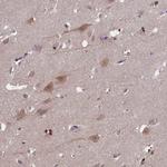 CKAP1 Polyclonal Antibody