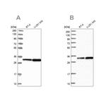 CKAP1 Antibody in Western Blot (WB)