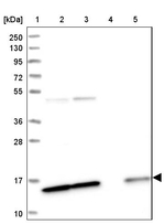 SNRPD2 Antibody in Western Blot (WB)