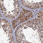 MIER2 Antibody in Immunohistochemistry (IHC)