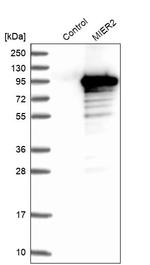 MIER2 Antibody in Western Blot (WB)