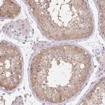 DNAJC5G Polyclonal Antibody