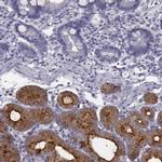 C6orf58 Antibody in Immunohistochemistry (IHC)