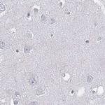 C6orf58 Antibody in Immunohistochemistry (IHC)