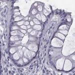 C6orf58 Antibody in Immunohistochemistry (IHC)