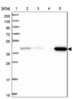 SBCAD Antibody in Western Blot (WB)