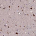 PLEKHG6 Antibody in Immunohistochemistry (Paraffin) (IHC (P))