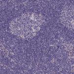 PLEKHG6 Antibody in Immunohistochemistry (Paraffin) (IHC (P))