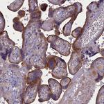 PLEKHG6 Antibody in Immunohistochemistry (Paraffin) (IHC (P))