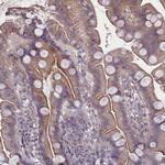 PLEKHG6 Polyclonal Antibody