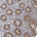 ANKRD26 Polyclonal Antibody