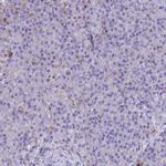 PZP Antibody in Immunohistochemistry (Paraffin) (IHC (P))