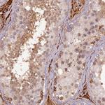 PZP Polyclonal Antibody