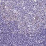 PZP Antibody in Immunohistochemistry (Paraffin) (IHC (P))