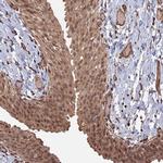 TELO2 Antibody in Immunohistochemistry (Paraffin) (IHC (P))