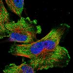 TIGD7 Polyclonal Antibody