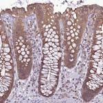 TIGD7 Antibody in Immunohistochemistry (IHC)