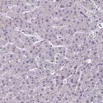 POLR3E Antibody in Immunohistochemistry (Paraffin) (IHC (P))