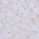 C16orf48 Antibody in Immunohistochemistry (Paraffin) (IHC (P))