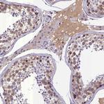 C16orf48 Antibody in Immunohistochemistry (Paraffin) (IHC (P))