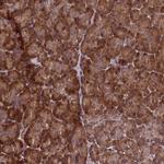 RBFA Antibody in Immunohistochemistry (Paraffin) (IHC (P))