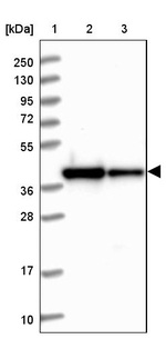 RBFA Antibody in Western Blot (WB)