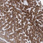 ANKS3 Polyclonal Antibody