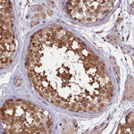 RIC8A Antibody in Immunohistochemistry (Paraffin) (IHC (P))