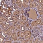 ATP10A Polyclonal Antibody