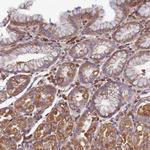 CCDC153 Polyclonal Antibody