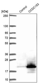 CCDC153 Antibody in Western Blot (WB)