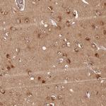 PPP1R37 Antibody in Immunohistochemistry (Paraffin) (IHC (P))