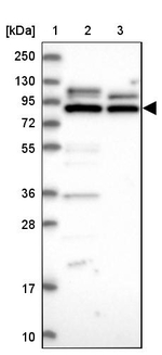 PPP1R37 Antibody in Western Blot (WB)