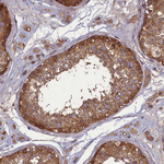 FAM96B Antibody in Immunohistochemistry (Paraffin) (IHC (P))