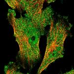 FAM96B Polyclonal Antibody