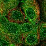 TMEM205 Polyclonal Antibody