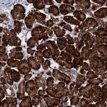 TMEM205 Antibody in Immunohistochemistry (IHC)