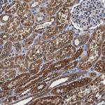 TMEM205 Antibody in Immunohistochemistry (IHC)