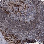 TMEM205 Antibody in Immunohistochemistry (IHC)