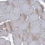 TMEM205 Antibody in Immunohistochemistry (IHC)