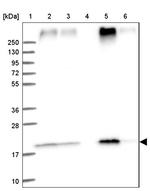 TMEM205 Antibody in Western Blot (WB)